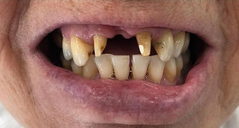 قبل العلاج 9